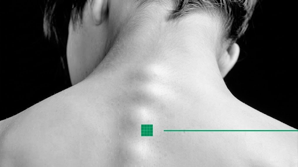 Nerve Block Treatment